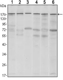 Anti-SETDB1 antibody [5H6D4] used in Western Blot (WB). GTX80409