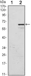 Anti-p57 Kip2 antibody [3E3] used in Western Blot (WB). GTX80412