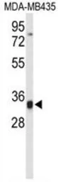 Anti-TFPT antibody, N-term used in Western Blot (WB). GTX80425