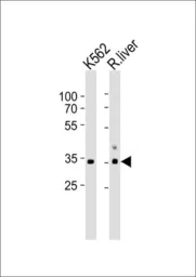 Anti-Sodium/Potassium ATPase beta 2 antibody, Internal used in Western Blot (WB). GTX80450