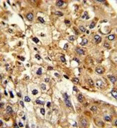 Anti-Sodium/Potassium ATPase beta 2 antibody, Internal used in IHC (Paraffin sections) (IHC-P). GTX80450