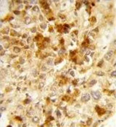 Anti-Peroxin 2 antibody, Internal used in IHC (Paraffin sections) (IHC-P). GTX80512