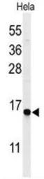 Anti-GABARAPL1 antibody used in Western Blot (WB). GTX80541