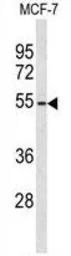 Anti-ADAMDEC1 antibody, N-term used in Western Blot (WB). GTX80550
