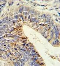 Anti-ADAMDEC1 antibody, N-term used in IHC (Paraffin sections) (IHC-P). GTX80550