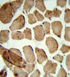 Anti-ULK1 antibody used in IHC (Paraffin sections) (IHC-P). GTX80551