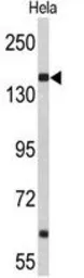 Anti-Nup153 antibody, N-term used in Western Blot (WB). GTX80552