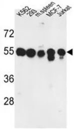 Anti-PPM1H antibody, Internal used in Western Blot (WB). GTX80567