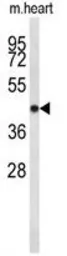 Anti-CDC2L6 antibody, Internal used in Western Blot (WB). GTX80572