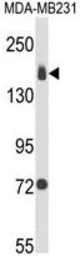 Anti-Integrin alpha 2 antibody, C-term used in Western Blot (WB). GTX80593