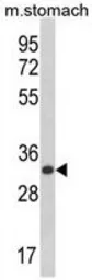 Anti-CDIPT antibody, Internal used in Western Blot (WB). GTX80599