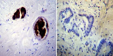 Anti-Adiponectin antibody [19F1] used in IHC (Paraffin sections) (IHC-P). GTX80683