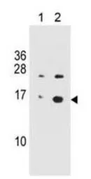 Anti-Histone H2A.XS139ph (phospho Ser139) antibody [3F2] used in Western Blot (WB). GTX80694