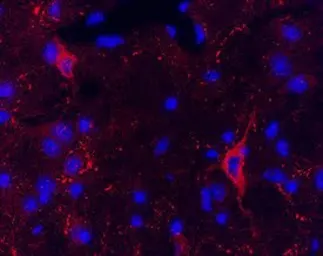 Anti-Proenkephalin antibody used in IHC (Frozen sections) (IHC-Fr). GTX80743