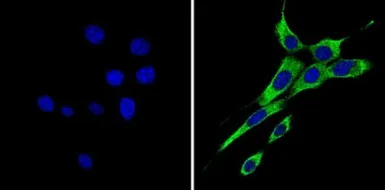 Anti-Her4 / ErbB4 antibody [HFR1] used in Immunocytochemistry/ Immunofluorescence (ICC/IF). GTX80811
