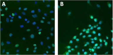 Anti-Lamin A + C antibody [mab636] used in Immunocytochemistry/ Immunofluorescence (ICC/IF). GTX80813