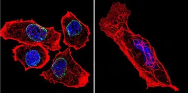Anti-Lamin A + C antibody [mab636] used in Immunocytochemistry/ Immunofluorescence (ICC/IF). GTX80813