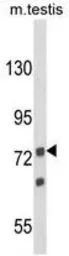 Anti-ANGEL1 antibody, C-term used in Western Blot (WB). GTX80925
