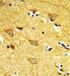Anti-INPP4B antibody, Internal used in IHC (Paraffin sections) (IHC-P). GTX80952