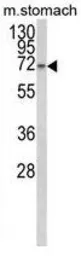 Anti-TCERG1L antibody, Internal used in Western Blot (WB). GTX80965