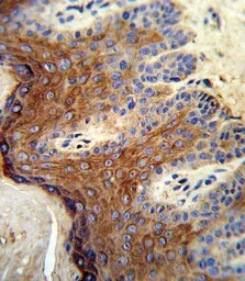 Anti-ALOX12 antibody, C-term used in IHC (Paraffin sections) (IHC-P). GTX80966