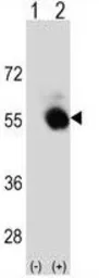 Anti-SELENBP1 antibody, C-term used in Western Blot (WB). GTX80973