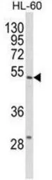 Anti-SELENBP1 antibody, C-term used in Western Blot (WB). GTX80973