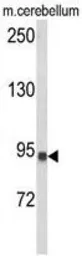 Anti-CASD1 antibody, N-term used in Western Blot (WB). GTX80980