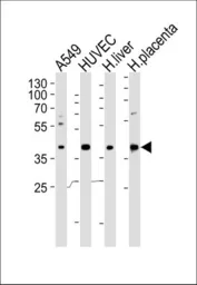 Anti-OLR1 / LOX-1 antibody, Internal used in Western Blot (WB). GTX80987