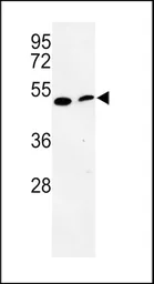 Anti-PISD antibody, Internal used in Western Blot (WB). GTX80997
