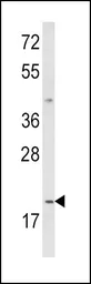 Anti-IL12A / IL12 p35 antibody, C-term used in Western Blot (WB). GTX81020