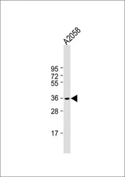Anti-IGH antibody, C-term used in Western Blot (WB). GTX81028