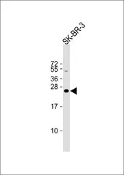 Anti-Derlin 1 antibody, C-term used in Western Blot (WB). GTX81054