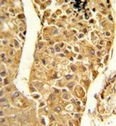 Anti-CYP2C18 antibody, C-term used in IHC (Paraffin sections) (IHC-P). GTX81067