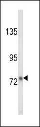 Anti-Lactoferrin antibody used in Western Blot (WB). GTX81085