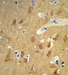 Anti-TSPAN12 antibody, C-term used in IHC (Paraffin sections) (IHC-P). GTX81087