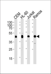 Anti-HLA-B antibody, N-term used in Western Blot (WB). GTX81138