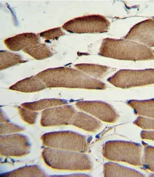 Anti-Wnt5b antibody, Internal used in IHC (Paraffin sections) (IHC-P). GTX81146