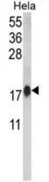 Anti-Calmodulin antibody, C-term used in Western Blot (WB). GTX81180