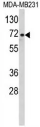 Anti-ARHGAP18 antibody, Internal used in Western Blot (WB). GTX81203