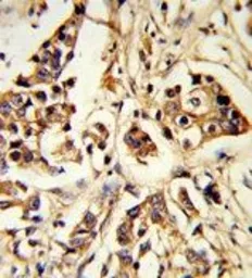 Anti-ARHGAP18 antibody, Internal used in IHC (Paraffin sections) (IHC-P). GTX81203