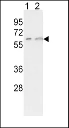 Anti-CYP7A1 antibody, C-term used in Western Blot (WB). GTX81230