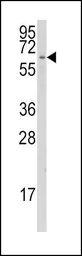 Anti-CYP1A1 antibody, C-term used in Western Blot (WB). GTX81232