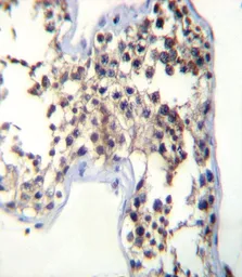 Anti-LH beta antibody, C-term used in IHC (Paraffin sections) (IHC-P). GTX81236
