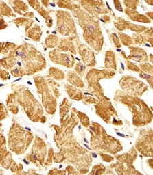 Anti-ROR1 antibody used in IHC (Paraffin sections) (IHC-P). GTX81334