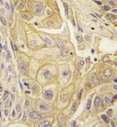 Anti-EphB2 antibody used in IHC (Paraffin sections) (IHC-P). GTX81348