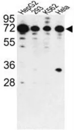 Anti-PHACTR2 antibody, N-term used in Western Blot (WB). GTX81354