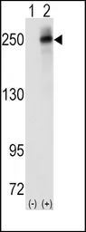 Anti-ALK antibody, Internal used in Western Blot (WB). GTX81366