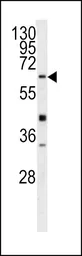 Anti-GGT5 antibody, N-term used in Western Blot (WB). GTX81477