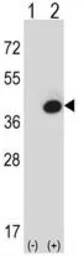 Anti-FBP1 antibody, Internal used in Western Blot (WB). GTX81482